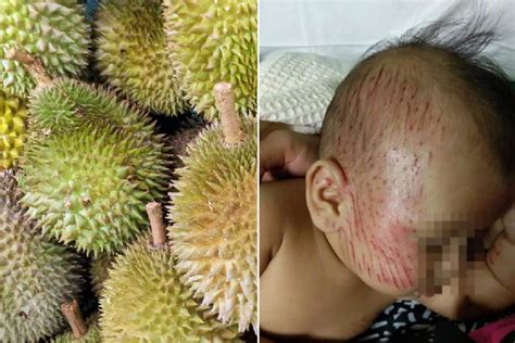 Leaves of different durian cultivars (photo doa malaysia). Baby and mother struck by falling durian in Pahang ...