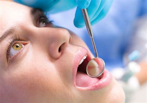Cavities take their toll in many ways. Topmost How Long Does It Take To Fill A Cavity At The ...