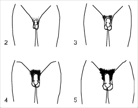 What are my pubic hair removal options? 5 Doubts About Men Pubic Hairstyles You Should Clarify ...