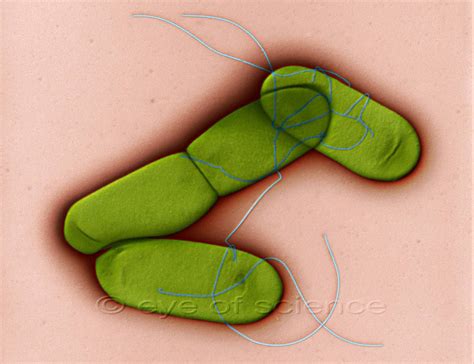 Listeria are gram positive, facultative anaerobes that are observed to be bacilli in short chains. Listeria Listeria are widely common as soil bacteria. They ...