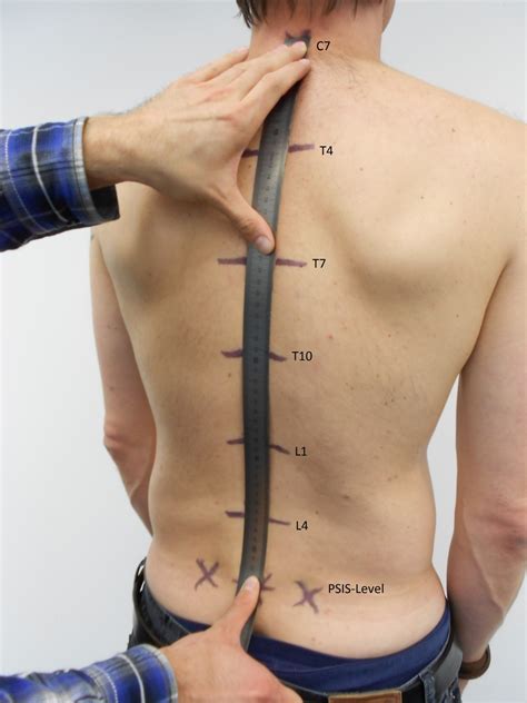 This is called referred pain, when you feel the pain. Determination of thoracic and lumbar spinal processes by ...