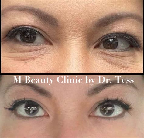 M Beauty by Dr Tess - Home | Facebook