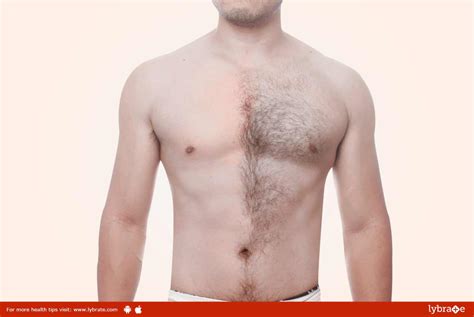 About 8 percent of women in the united states have some form of excessive hair growth. Excess Body Hair - How To Get Rid Of It? | DietWanted.com ...