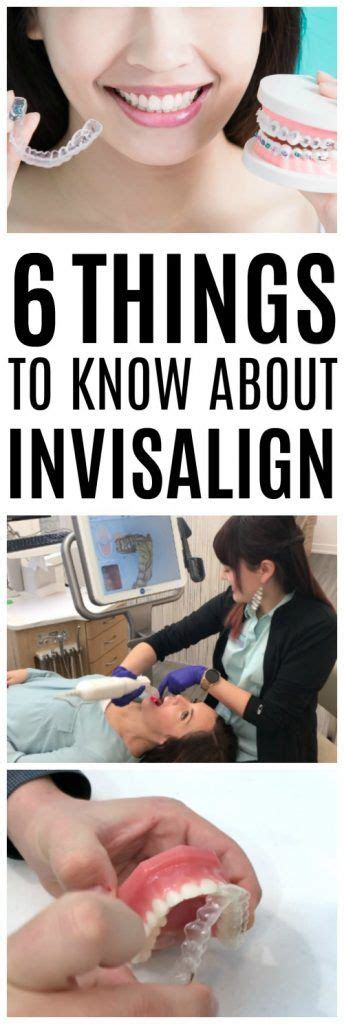 We did not find results for: 6 Things to Know About Invisalign - Defay Orthodontics