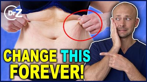 Shed some pounds and need to tighten loose skin? Can You Tighten LOOSE SKIN? DOCTOR ANSWERS! - YouTube