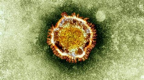 Sars is an airborne virus and can spread through small droplets of saliva in a similar way to the cold and it was the first severe and readily transmissible new disease to emerge in the 21st century and. SARS-Like Virus May Be Spreading Through Human Contact ...