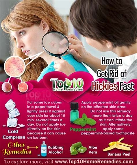 This also will apply to jins which are also known as the legendary tailed beasts. How to Get Rid of Hickies Fast | Top 10 Home Remedies