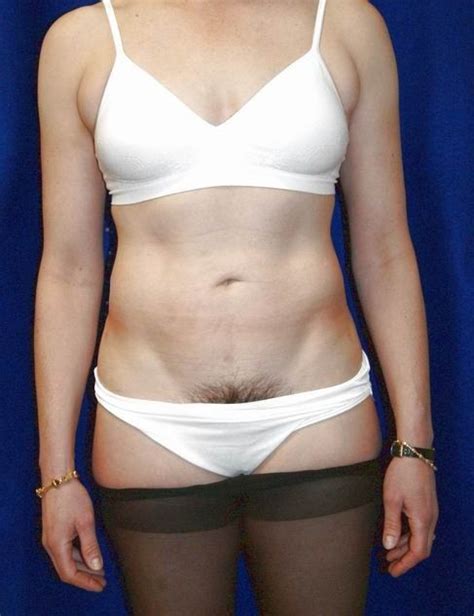 Mulani banged after hot massage. Body sculpting plastic surgery transsexual . Porn Pics ...