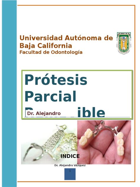 Que está contido num todo: Manual de Protésis Parcial Removible | Dentadura postiza | Diente humano