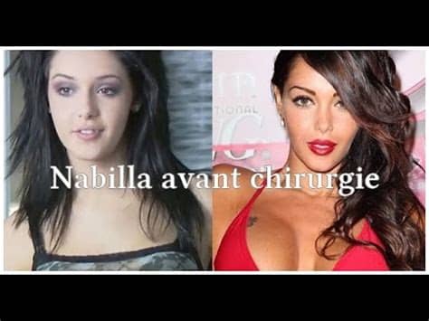 En effet la jeune femme va se rendre en tunisie pour y subir plusieurs interventions après plusieurs critiques faites sur son physique, aurélie dotremont a décidé de s'envoler pour la tunisie dans le but de se faire opérer. NABILLA AVANT CHIRURGIE - YouTube