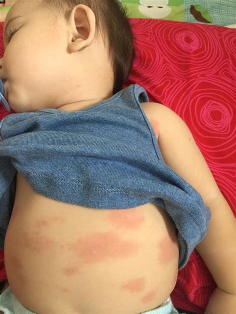 Berak darah atau bisa disebut hematochezia ditandai dengan keluarnya darah berwarna merah terang dari anus.darah tersebut dapat gejala penyakit berak darah: Padah Susu Tiruan, Kalau Anak-anak Ada Tanda Macam Disebut ...