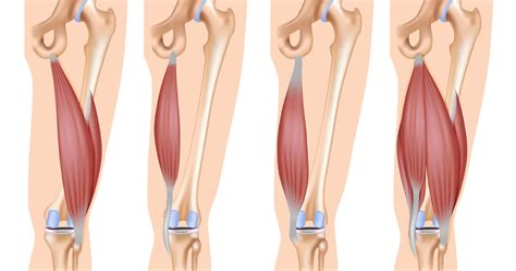 Tight hamstrings can cause stiffness and limit mobility. Why Are My Hamstrings Always Tight? - Girls Gone Strong