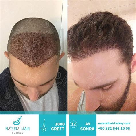 We did not find results for: Saç Ekimi Öncesi ve Sonrası - Natural Hair Turkey