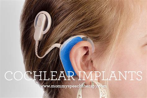 If you already have an audiogram and you have questions about it or would like to use it for ordering purposes, then please do get in touch on email: Cochlear Implants | Mommy Speech Therapy