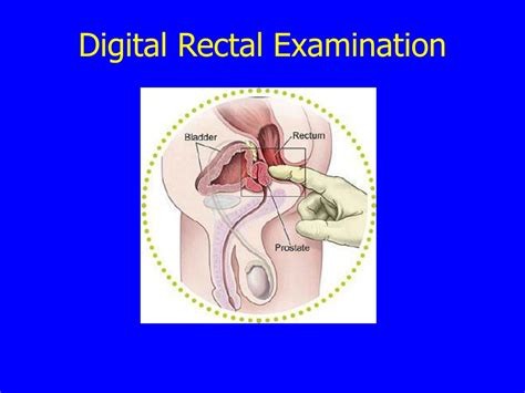 We examine our patients in comfortable surroundings and a convenient time for the patient. PPT - BIOE 301 PowerPoint Presentation, free download - ID ...