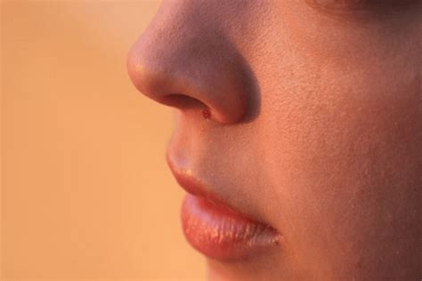 On the nose there are smooth hairs and receptors that sensitive to gas or vapor. Sores in Nose Causes and Treatment