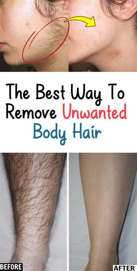 Not only does it smoothly remove the hair from the private area but it also hydrates the skin and does not pave way for itches and keeps it cool down there. The Best Way To Remove Unwanted Body Hair? (With images ...