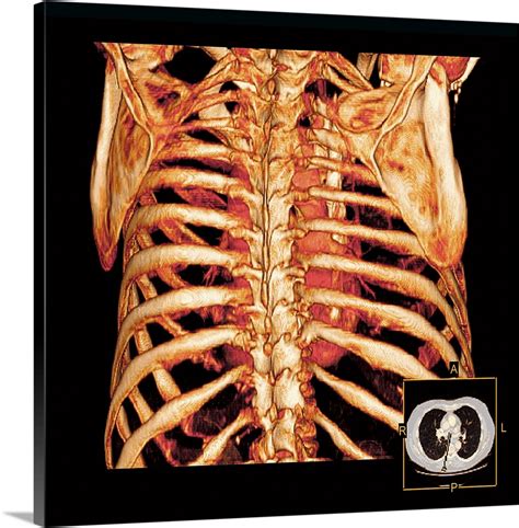 The regions of the body are labeled in boldface. Rib Cage Anatomy Posterior View - Download Posterior View ...