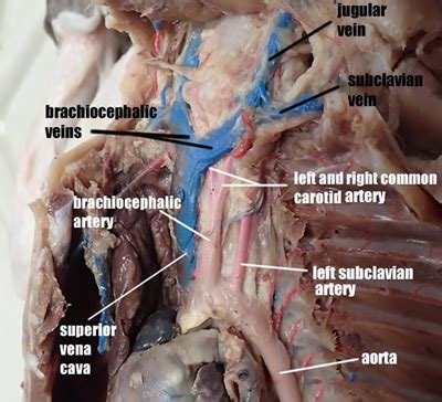 Most t cells remain in blood vessels, but some. Anatomy & Physiology