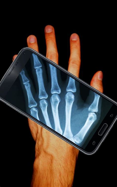 There are opinions about xray photo yet. Real Body Scanner App Download For Android - eagletree