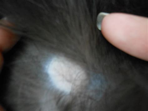 Find out why and how to deal with alopecia in cats. I have an outdoor cat and just noticed this round spot, it ...