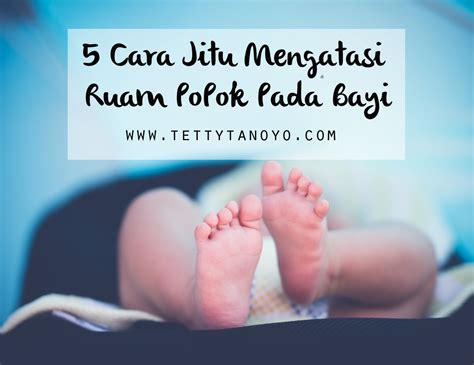 5 Cara Jitu Mengatasi Ruam Popok Pada Bayi | Family ...