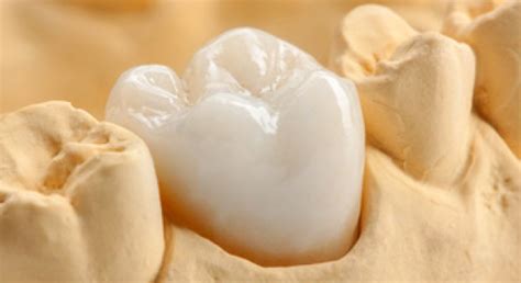 Abrufstatistik (neuer tab) visualisierung eingehender und ausgehender links (2 ebenen, neuer tab) 3häufigkeit: Zahnärztin Petra Sulik, M.Sc. - Prothetik | Zahnärztin in ...