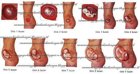 Cara paling aman dan efektif untuk menggugurkan kandungan di bawah 12 minggu adalah kombinasi mifepristone dan misoprostol. Cara Aman Menggugurkan Kandungan