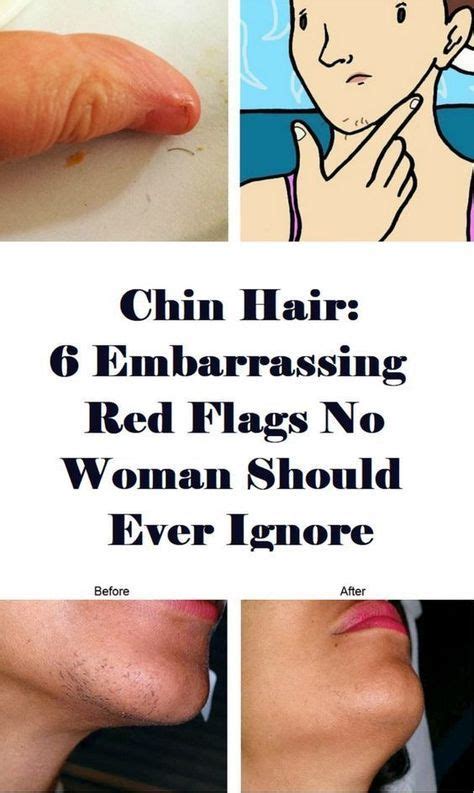 I'll be shaving once i get down to my goal weight if only because i don't like. Female Chin Hair: What Causes It and What It Could Tell ...