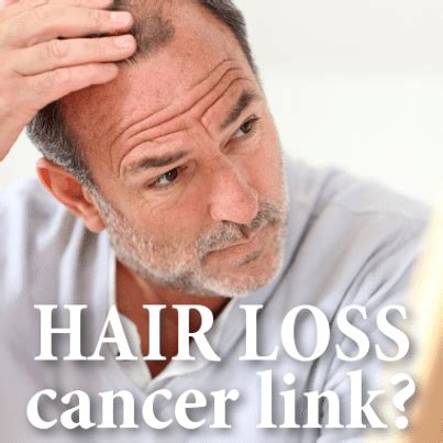 Drs: Male Patterned Baldness Linked To Prostate Cancer ...