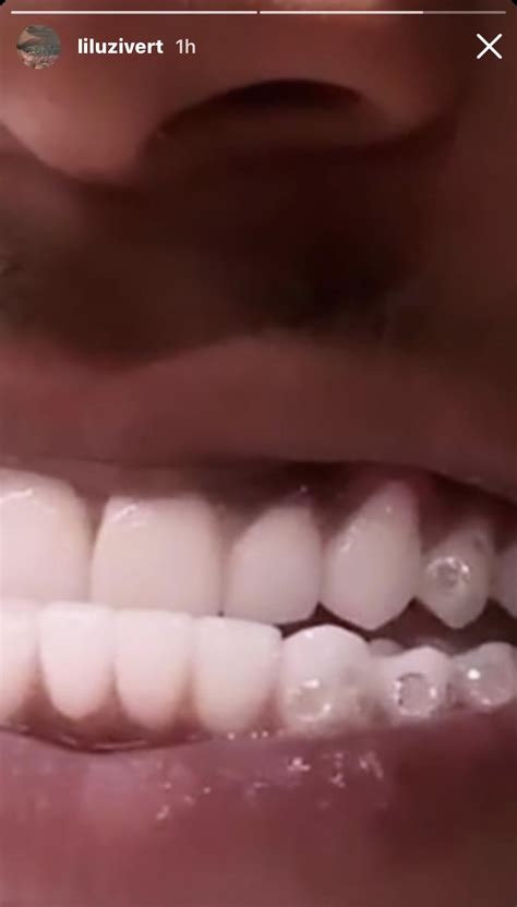 At the time, uzi tweeted that he had been saving up for the 11 carat rock for 4 years so he could have a lot of m's in my face. Lil Uzi Vert Diamond Teeth - Jva5qqudx9trrm - The rapper's ...