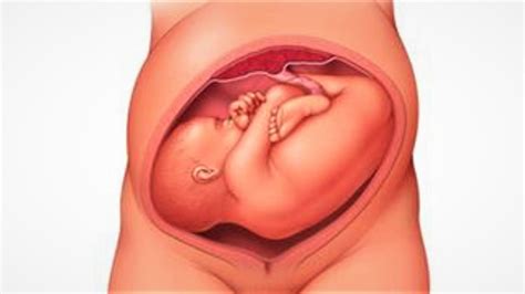 Melintang Posisi Bayi Sungsang 7 Bulan - Guru Paud