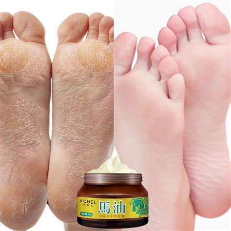 Diy foot soak wiil remove all dead skin and make feet soft and pretty! Chel Feet - Five Feet Apart Review Irfan Review Films ...