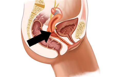 Bohl says this hypothesis isn't backed up by science, it's definitely. Penis hitting cervix. Penis hitting cervix.