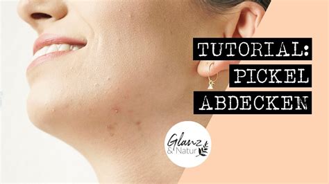 Behandlung microneedling, hilft auch gegen pickelmale und akne narben. Tutorial: Pickel & Pickelmale richtig abdecken - vegan und ...