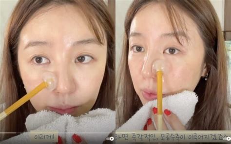 Hanya dalam 8 minggu penggunaan yang konsisten, korang pasti dapat rasakan perubahan besar berlaku pada kulit muka. Cara Yoon Eun Hye Kecilkan Liang Pori Muka Dengan Ais Saja ...