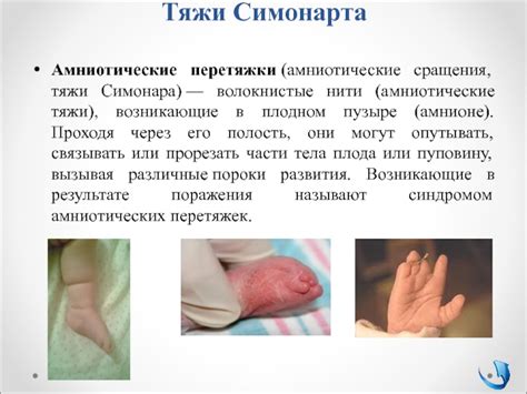 The placenta is a temporary fetal organ that begins developing from the blastocyst shortly after implantation. Патология последа. Часть I презентация, доклад