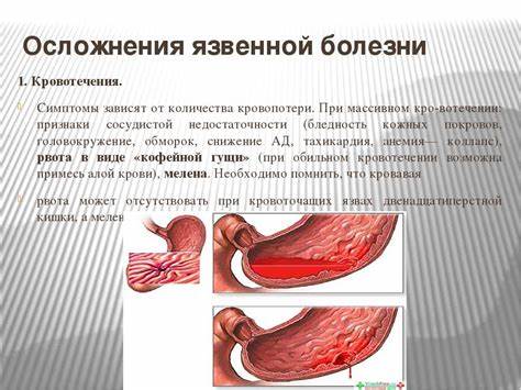Диета при желудочно кишечного кровотечения Кровотечение при язве желудка, симптомы и лечение, последствия Кровотечение при язве желудка, симптомы и лечение, последствия Диета при желудочно кишечного кровотечения