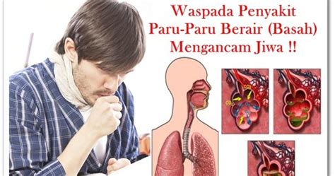 Apabila hal ini terjadi, fungsi jantung dan pembuluh darah dapat terganggu, sehingga tekanan darah pun meningkat. Faktor Apa Yang Dapat Menyebabkan Penyakit Paru Paru Bisa ...