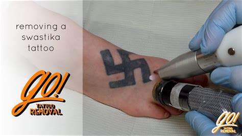 Laser tattoo removal is the process of firing lasers at your skin to remove a tattoo. Removing A Swastika Tattoo - YouTube