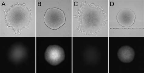 Features of the colonies may help to pinpoint the identity of the bacterium. Colony morphology (top) and fluorescence intensity (bottom ...