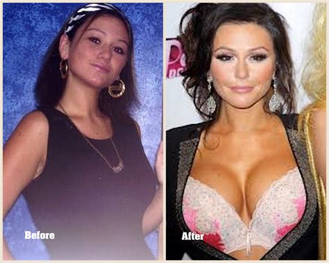 From 2008 to 2013, she was manager and director of the music ensemble eighth blackbird, which won numerous grammy awards. Jwoww Plastic Surgery Before and After Photos 2013-2014