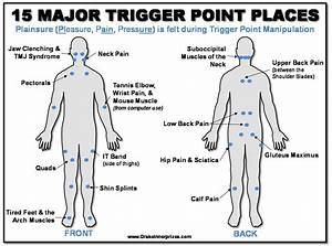 Could You Be Suffering From Trigger Points Health Jamaica Gleaner