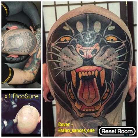 Tattoos | Natural tattoo removal, Tattoo removal, Laser ...