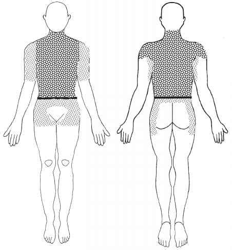 _ branny scales, accentuated by scratching with glass slide. Foods To Avoid With Hives - Central Lakes Medical