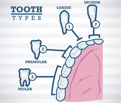 I had 4 wisdom teeth removed under general anaesthesia and i still had pain day 5, mostly around the gum hole area. How to Sleep after Wisdom Teeth Removal: Basic Info & Tips