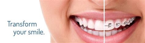 Check spelling or type a new query. Best Local Orthodontist Near Me in 2020 | Orthodontist ...