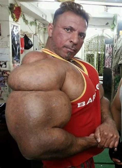 Anabolic steroids are a class of steroids that interact with androgen receptors to increase muscle and bone synthesis. When Steroid Use Goes Terribly Wrong - Gallery | eBaum's World