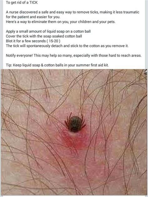 How to remove ticks | a quick fix for ticks. Tick removal | Useful life hacks, Simple life hacks, Tick ...