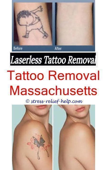 Cut a lemon into two halves and then squeeze out its juice. the best tattoo removal how long does it take to get laser ...